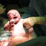 caesarean-picture-id115610747